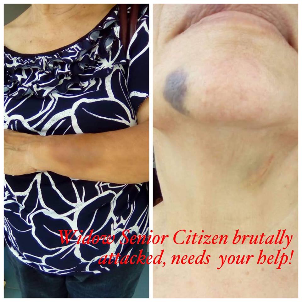 Widow Senior Citizen brutally attacked, needs your help !